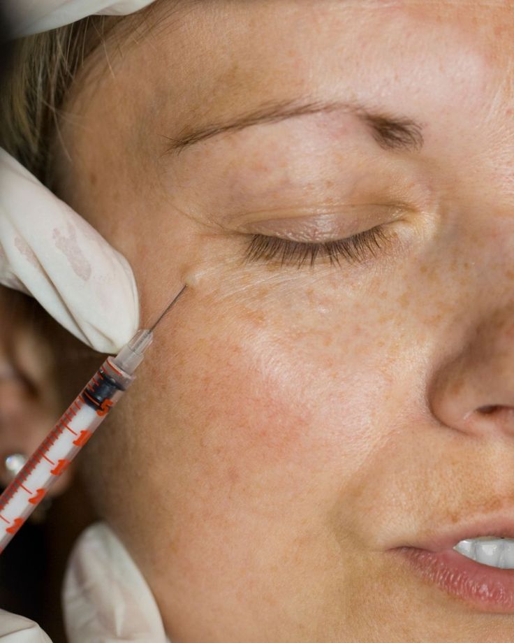 Consulta con cirujano maxilofacial